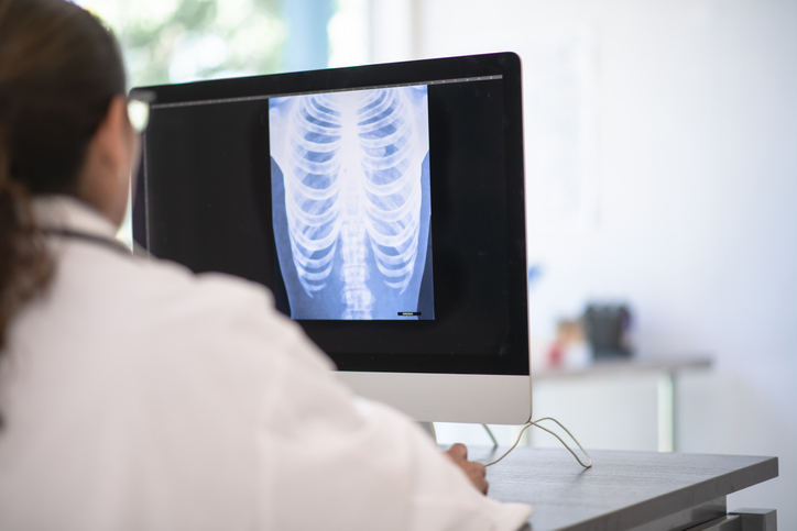 A doctor sits at their desk and looks at an x-ray of someone's chest. They are in a bright sterile office.